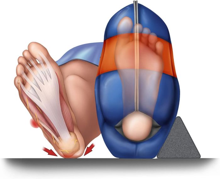 Sage Prevalon III Pressure Relieving Heel Protector Boot w/ Wedge