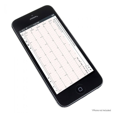 iCV200 Cardioview Resting ECG