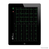 iCV200 Cardioview Resting ECG