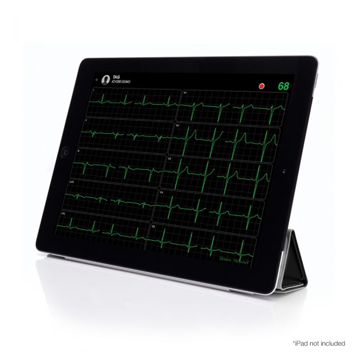 iCV200 Cardioview Resting ECG