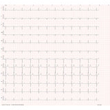 iCV200 Cardioview Resting ECG