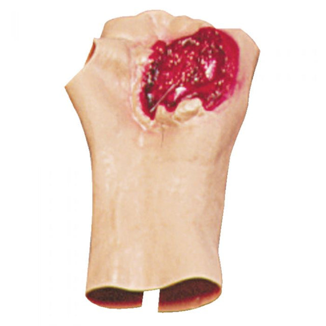 Bleeding Moulage (Gunshot Wound of the Palm)