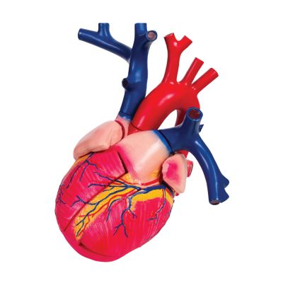 Enlarged Heart Model